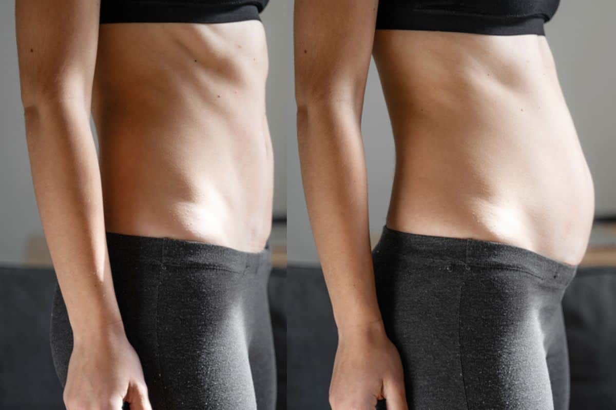 How long does diastasis recti take to improve Southend?