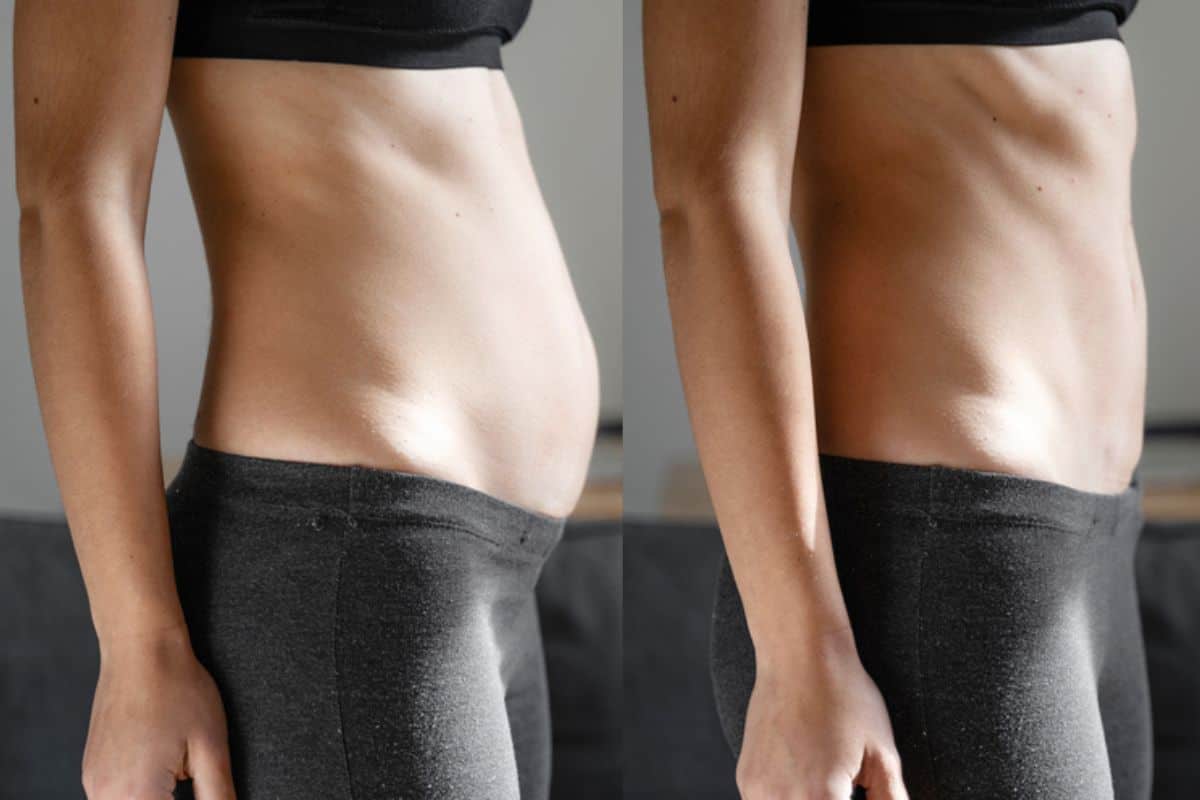 Post-Pregnancy: What Happens to Your Abdominal Muscles After Birth Southend