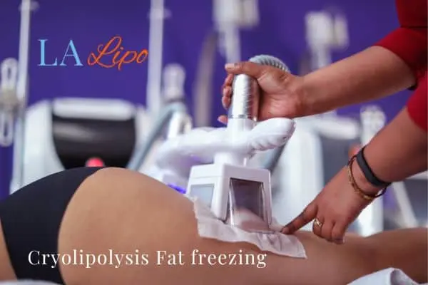 women getting fat freezing Southend