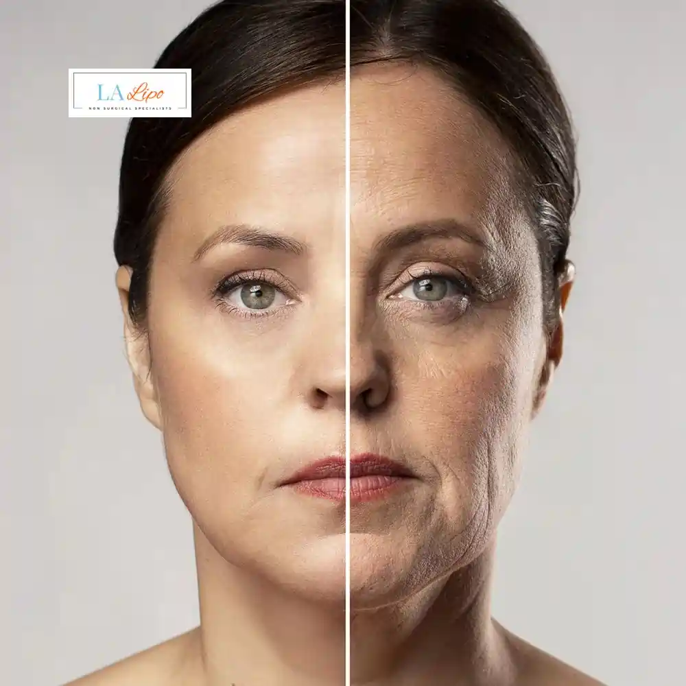 How Can You Tell If Non-Surgical Skin Tightening Is Right for You Southend?