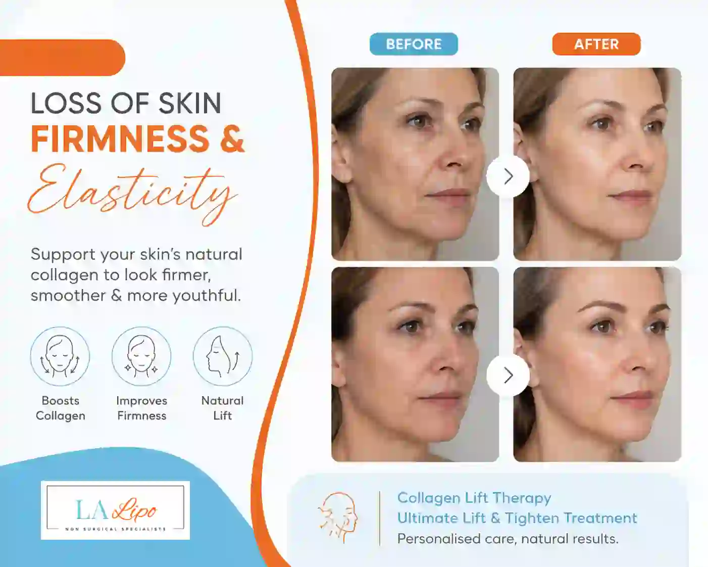 Sign #7: Loss of Skin Firmness and Elasticity Southend