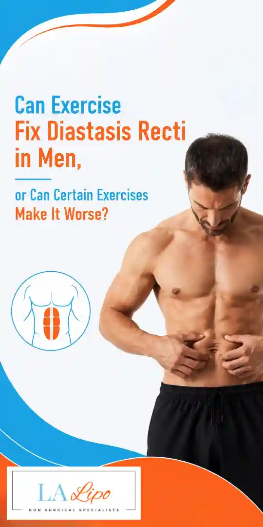 Can Exercise Fix Diastasis Recti in Men, or Can Certain Exercises Make It Worse Southend?